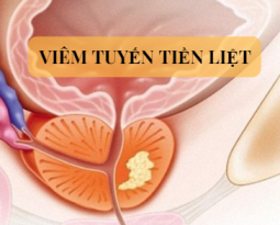 bieu-hien-viem-tuyen-tien-liet
