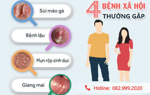 các bệnh xã hội