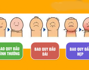 Con bị hẹp/dài bao quy đầu – Đừng vội cắt nếu chưa biết những điều này