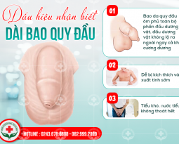 xu-ly-hieu-qua-dut-khoat-hien-tuong-bao-quy-dau-gia-cung-chuyen-gia