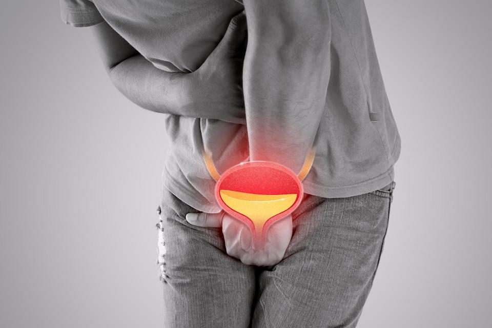 Viêm Tuyến Tiền Liệt Triệu Chứng Và Cách Điều Trị Hiệu Quả - Phòng khám Đa  khoa Quốc tế - 152 Xã Đàn, Đống Đa, Hà Nội