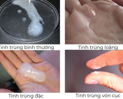 vi-sao-tinh-trung-bi-von-cuc-co-anh-huong-kha-nang-sinh-san-khong